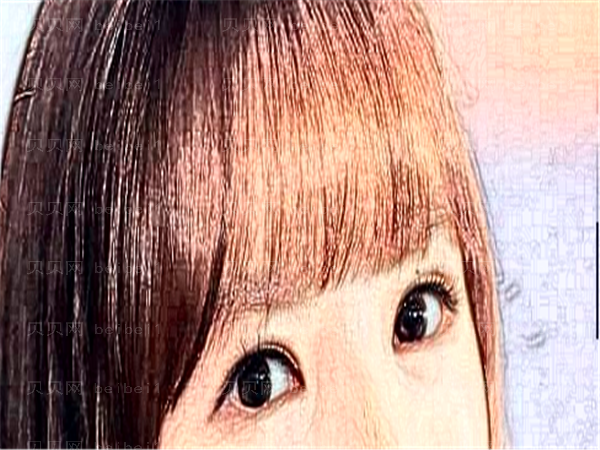 重庆美莱整形眼睑下至价目刷新!不看后悔系列