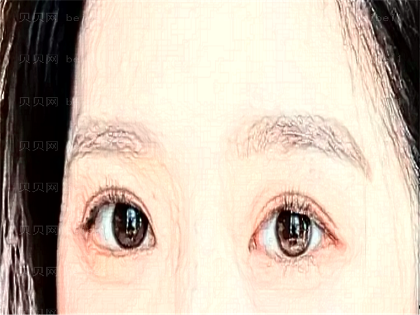 济南施尔明眼科近视手术实力怎么样?关注这三位就对了!