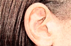广东耳朵畸形修复专家介绍,前四名单查看