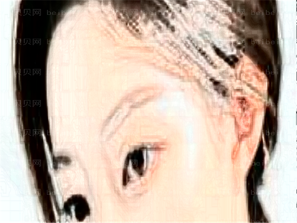 吕梁爱尔眼科医院近视手术可做哪些项目?附价格一览