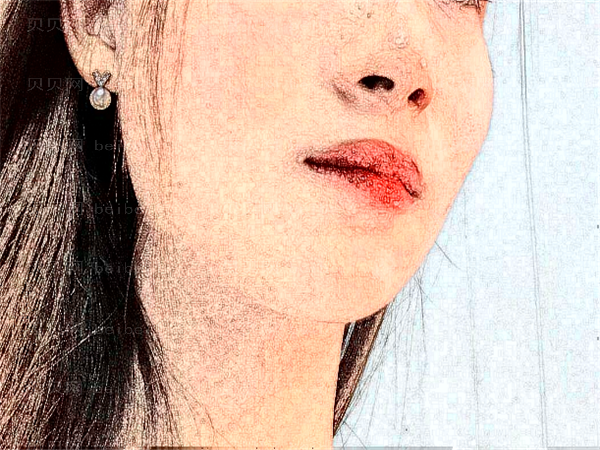 杭州清吟医疗吸脂瘦脸整形价格揭晓,都是高分好评!