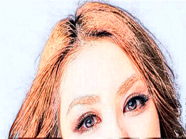 兰州皙妍丽整形植发养发实力怎么样?这些专家好评炸裂!