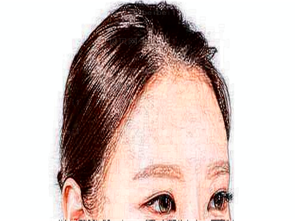 南京近视手术整形专家介绍,医生名单一览