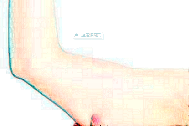 湖州共振吸脂瘦手臂医院排行公开?名单来了!