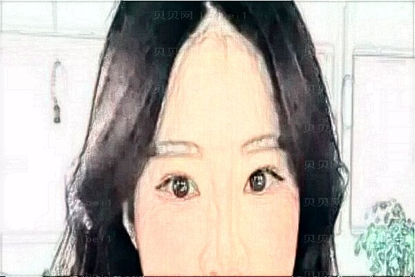 常熟瑞丽美贝尔开眼角整形医生排名2022