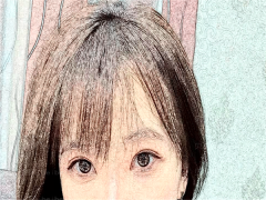 兰州仁和医院丰太阳穴有风险吗?关注这几位专家就对了！