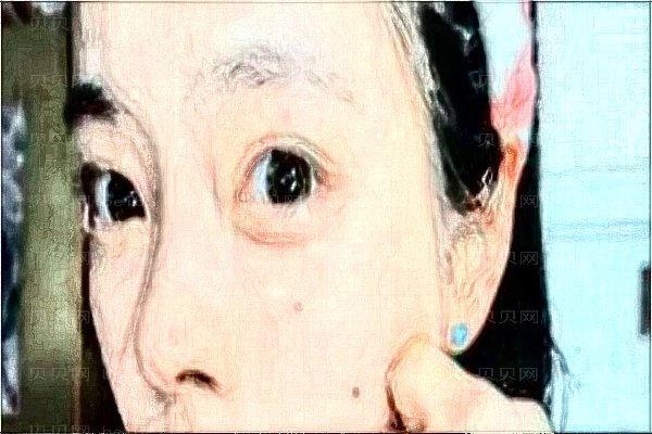宁夏慧清雅妍玻尿酸口碑好吗?