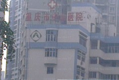重庆中山医院鼻翼缩小术后恢复的怎么样?附人气医生名单介绍