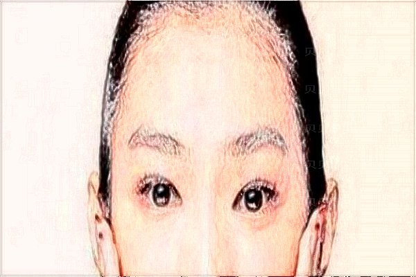 宝鸡爱容妍吸脂医生哪个好?测评如何