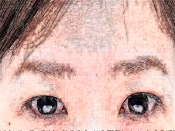 黑龙江内切去眼袋医生介绍揭幕,前七实力派揭晓
