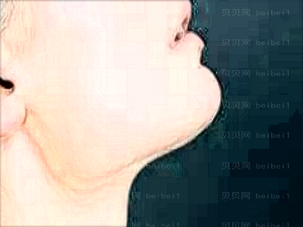 武汉亚韩整形医院做的怎么样?好的医生有哪些