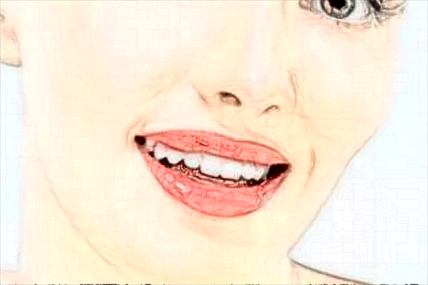 方脸如何能变成瓜子脸?术后自然吗?