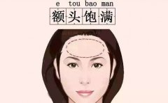 广州丰额头整形医生介绍前十位公布