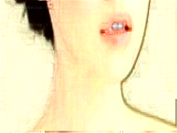 上海祛红血丝整形专家介绍_前三名单查看