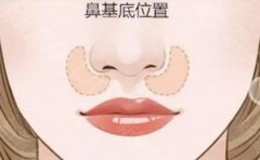 上海做鼻子哪家医院强