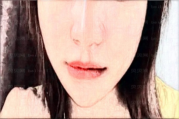 南京医科大学友谊整形外科垫下巴医生名单