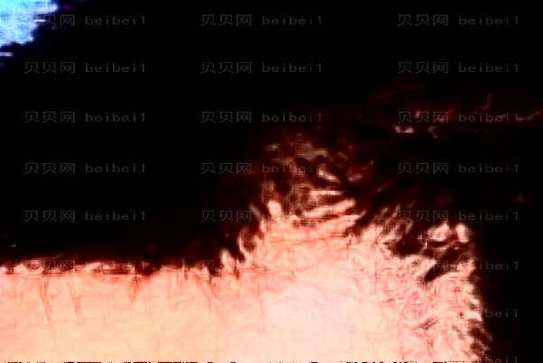 甘肃毛发移植专家介绍,前四各具实力特色