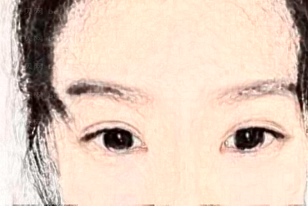都江堰爱尔眼科医院近视手术医生实力揭晓,都是高分好评