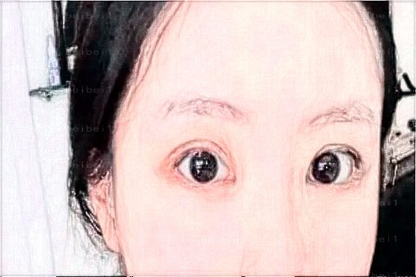 成都美容整形医院下眼睑下至好的医生名单公布