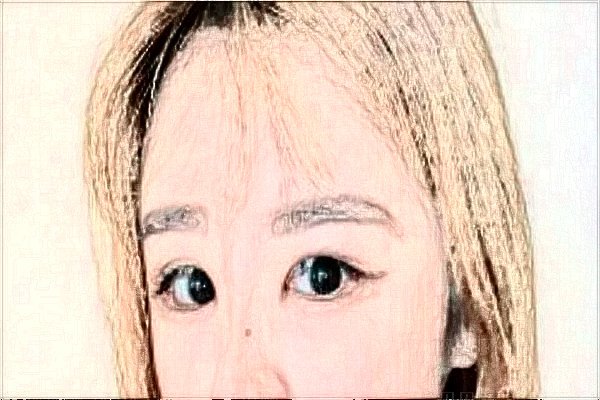 郑州壹加壹眼部综合谁做的好啊?给点意见