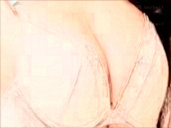 郑州乳头内陷矫正口碑医生介绍