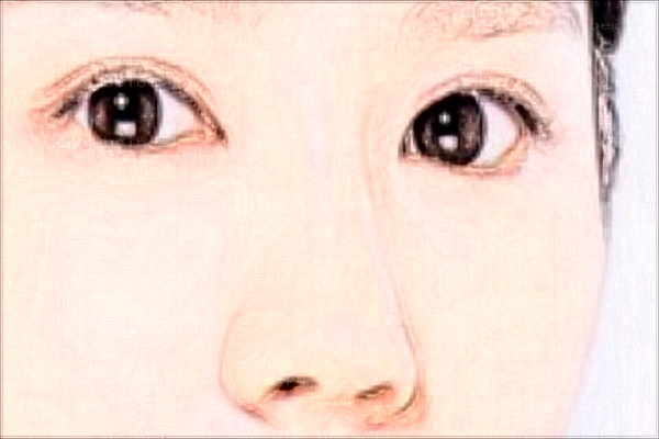 惠州耳软骨垫鼻尖整形医生介绍