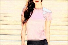 唐山苏亚美联臣腰腹环吸医师名单!审美超好