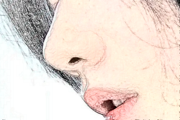 北京韩啸硅胶隆鼻怎么样?哪个医生做的好?