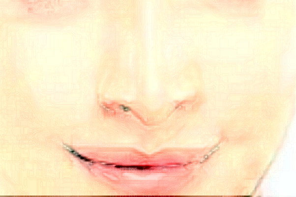北京丽星翼美隆鼻怎么样?哪些医生好?