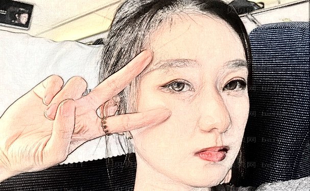 玻尿酸丰耳垂技术好吗