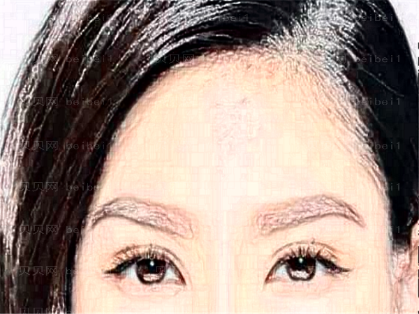 北京美莱眼部整形谁做的好,前十医生介绍