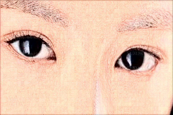 青岛去黑眼圈哪位做得好