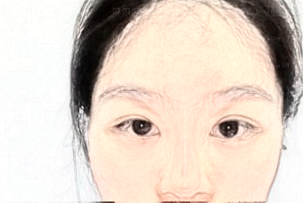 包头嘉美注射瘦脸好不好?哪个医生好?