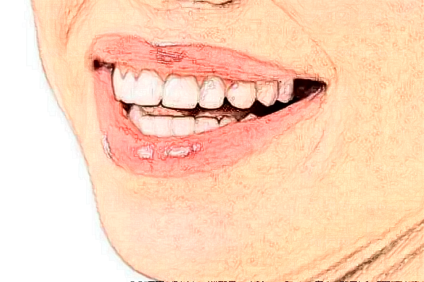 绵阳牙齿整形医生榜单预览|专家前三简介