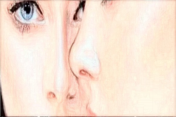 江阴时光医疗美容医院硅胶隆鼻好不好
