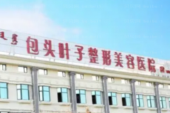 包头叶子做双眼皮哪些医生好?医生名单公布