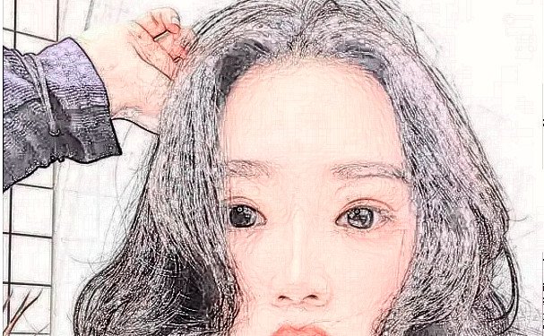 扬州秃顶植发好的医院名单!