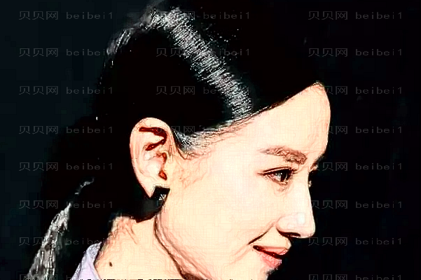 无锡同舟歪鼻矫正做的好不好