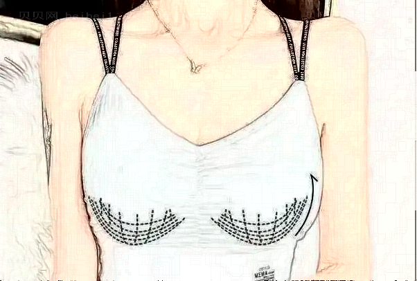 东莞韩美去副乳口碑医生名单公布