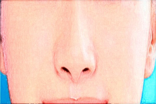 南充华美名媛隆鼻好不好