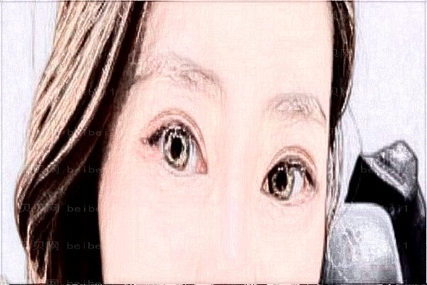 义乌柠栎整形吸脂好的医生名单出炉