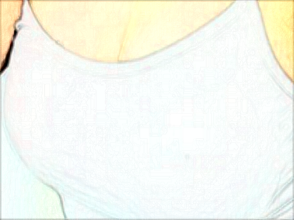 南阳乳头内陷矫正十大整形医院