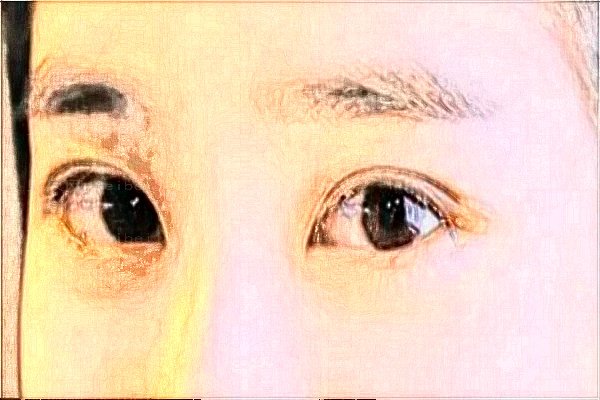 周口缔莱美开眼角谁比较擅长