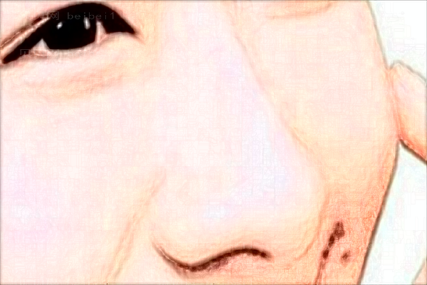 扬州鼻部整形医院哪家好?医院介绍!