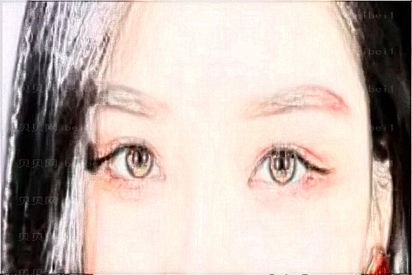 广医三院眼部整形口碑怎么样