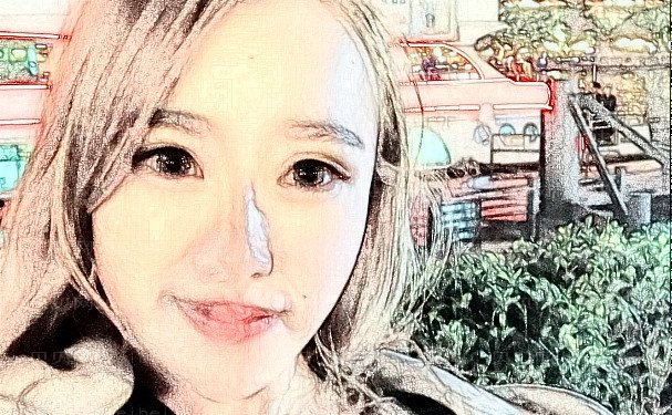 武汉大学中南医院植发手术怎么样