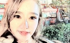 石家庄自体脂肪填充比较牛的医生揭晓