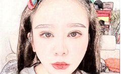 株洲延长鼻小柱哪家医院好