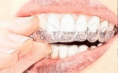 台州牙齿矫正的整形医院公布