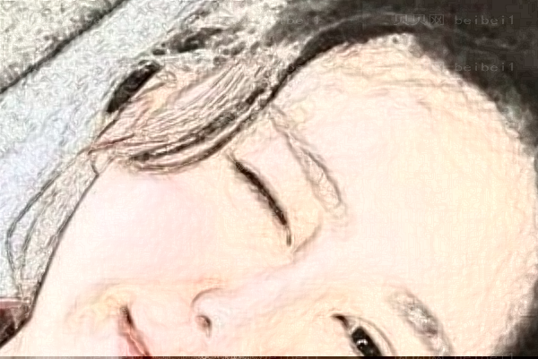 郑州壹加壹做隆鼻改良短鼻怎么样?